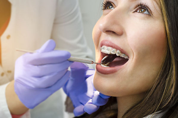 Dental hygienist performing a dental cleaning on a patient with braces, showcasing oral health care and preventive dental services.