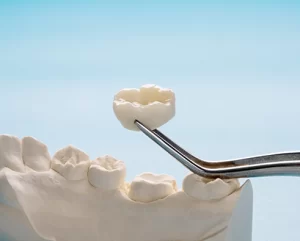 dental crowns