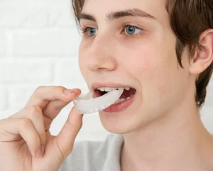 mouth guards