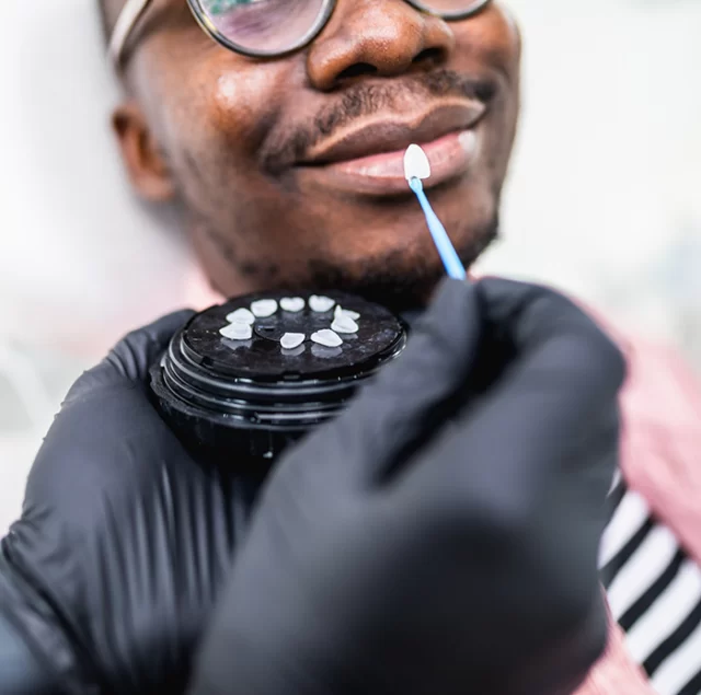 Smiling man receiving dental veneers treatment, showcasing porcelain veneer samples and dental tools in a cosmetic dentistry setting.
